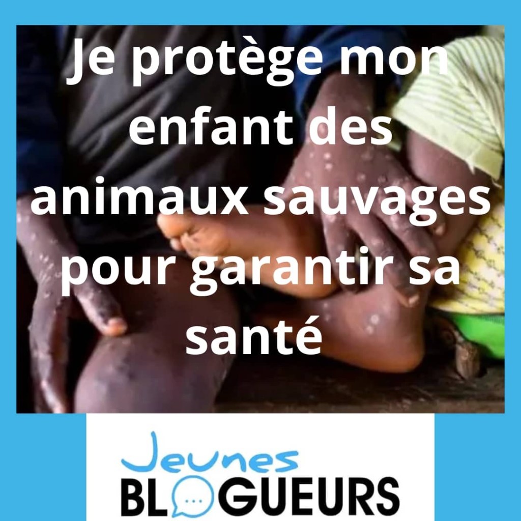La Variole du Singe en Côte d’Ivoire/ Comment l’Éviter et Protéger nos Enfants à l&rsquo;Approche de la Rentrée Scolaire&nbsp;?